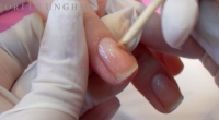 Nails Anatomy: do we really know it?