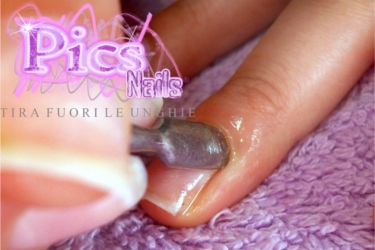 Nails Cuticles