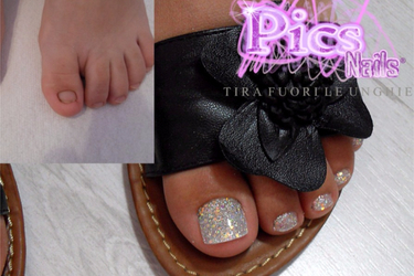 Toe Nails Trauma: can Nails Extension be the Solution? | Pics Nails