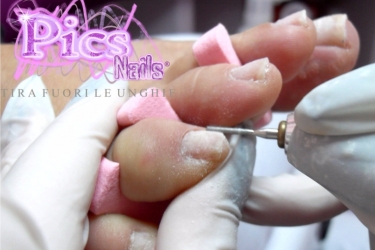 Utilizzo della Fresa per Pedicure