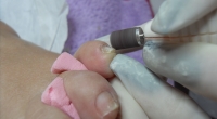 Which are the Differences between an Aesthetic Pedicure and a Therapeutic Pedicure?