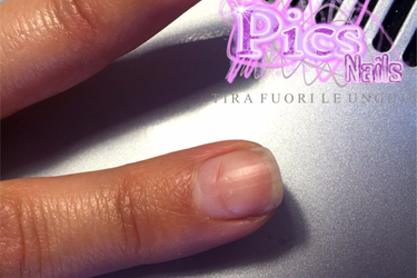 wrong manicure cuticle
